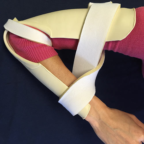 Elbow Flexion Splint